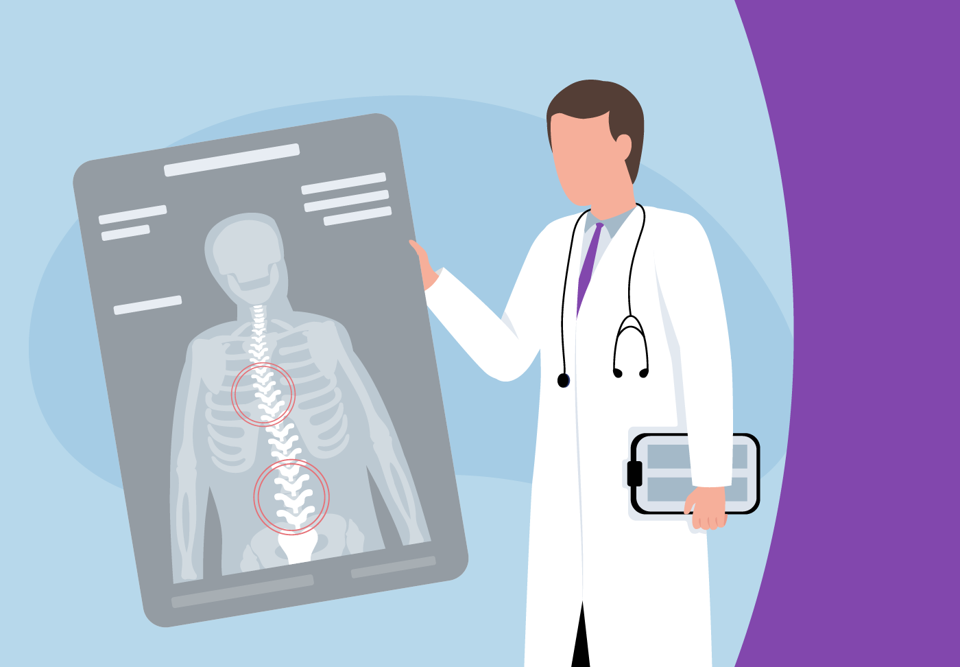 Wellstar Offers Life-Changing Adult Scoliosis Surgery For adults with severe cases of degenerative scoliosis, spinal deformity correction may be necessary due to significant pain, limited movement or deformity.