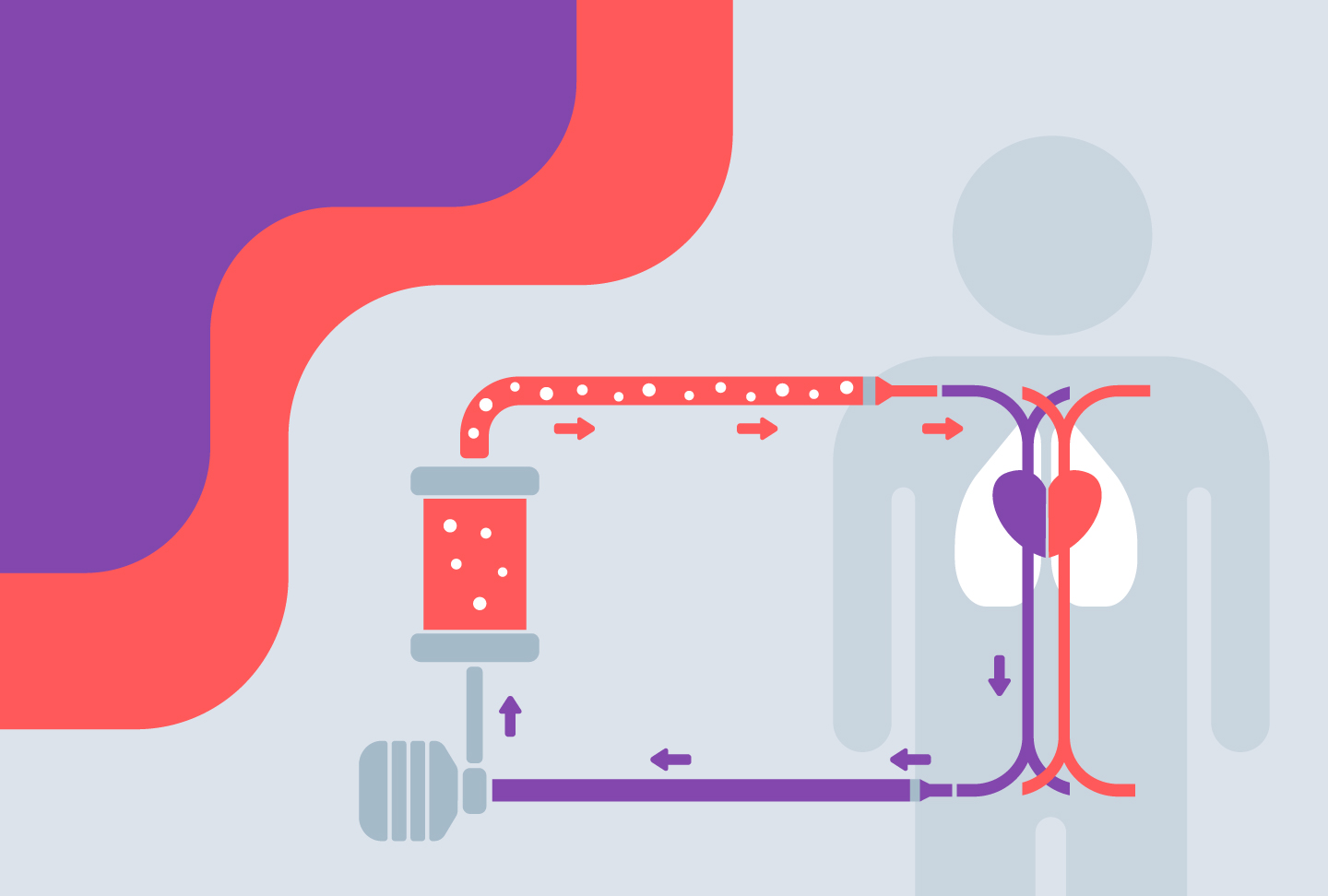 Unique Challenges for ECMO in this Pandemic Illustration depicting ECMO treatment process