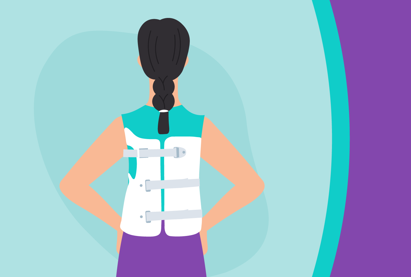 Comfortably Treating Scoliosis with 3D-Printed Braces Illustration of person wearing brace