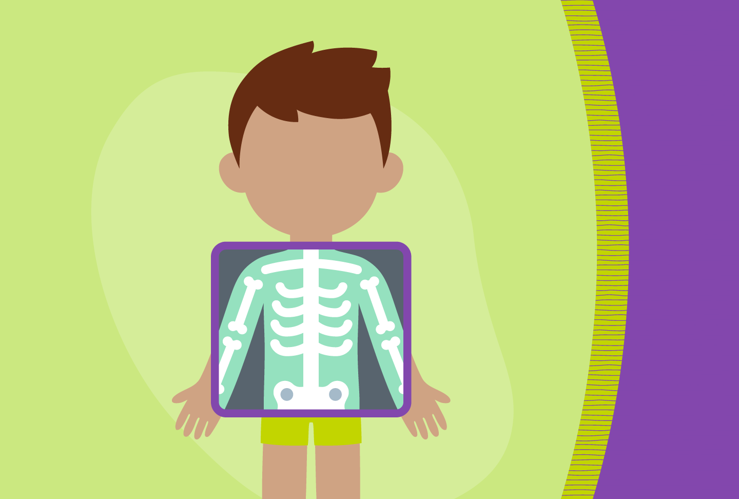 Wellstar Pediatric Orthopedics Cares for Children’s Growing Bones Illustration of child getting X-ray