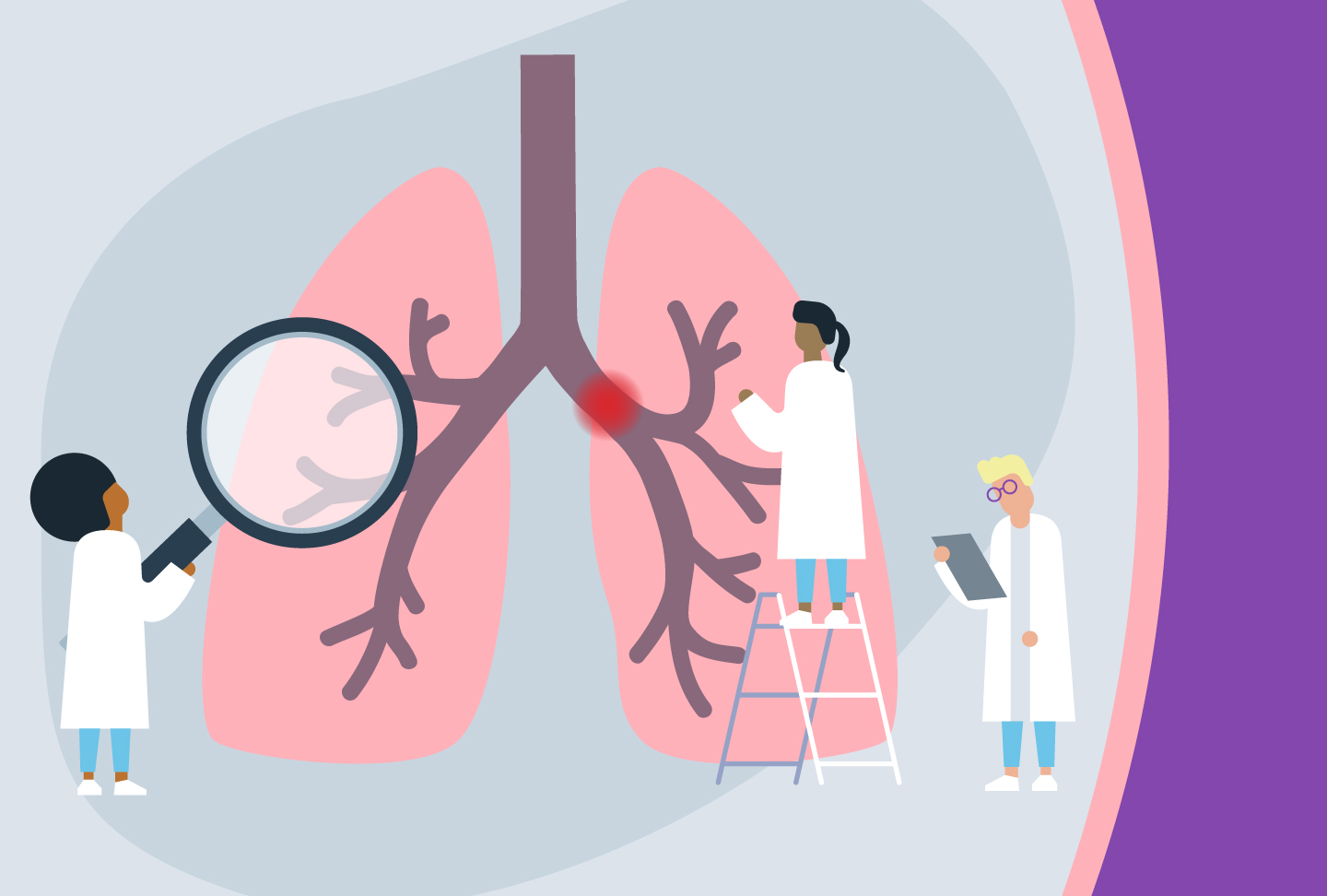 New Wellstar Health System Initiative Strives to Improve Outcomes for Patients with Pulmonary Embolisms Illustration of providers looking at blocked artery in lung