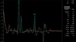 mrspectroscopy4