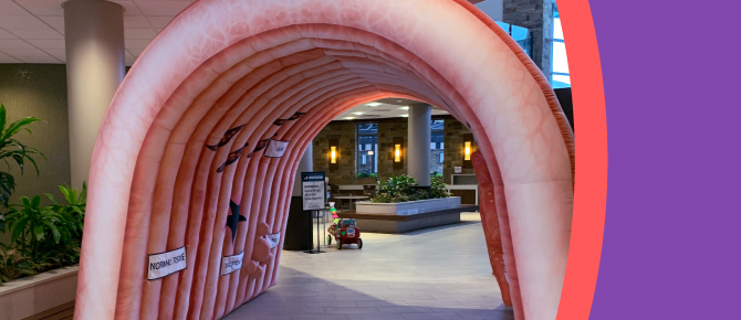 Photo of inflatable colon