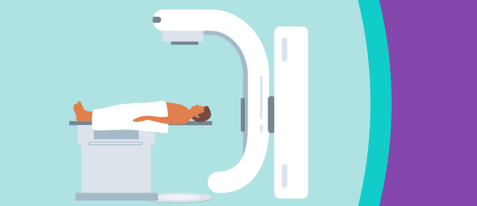 Illustration of patient and linear accelerator