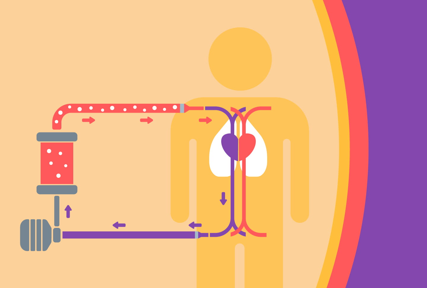 Illustration showing how ECMO treatment works.