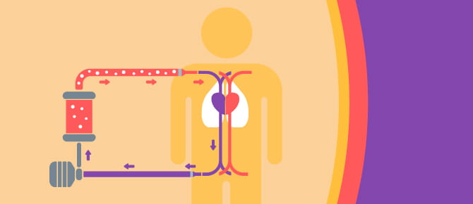 Illustration showing how ECMO treatment works.