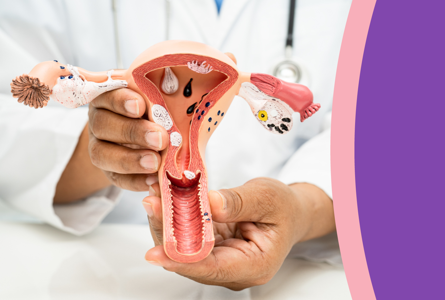 Doctor holding model of reproductive system