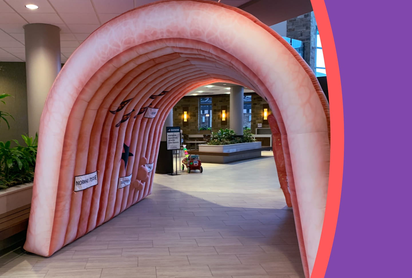 Photo of inflatable colon