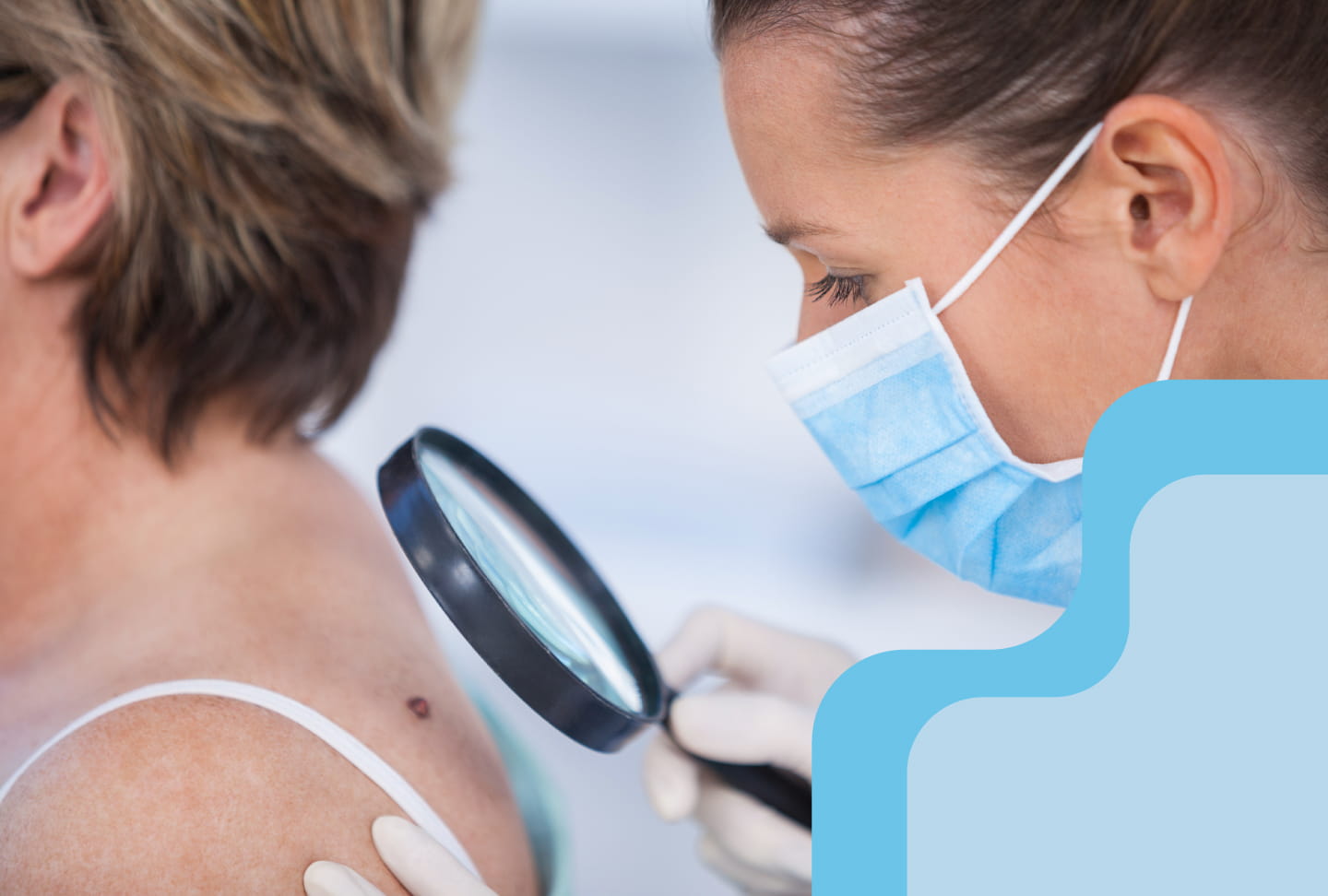 Spotting Skin Cancer Early Image