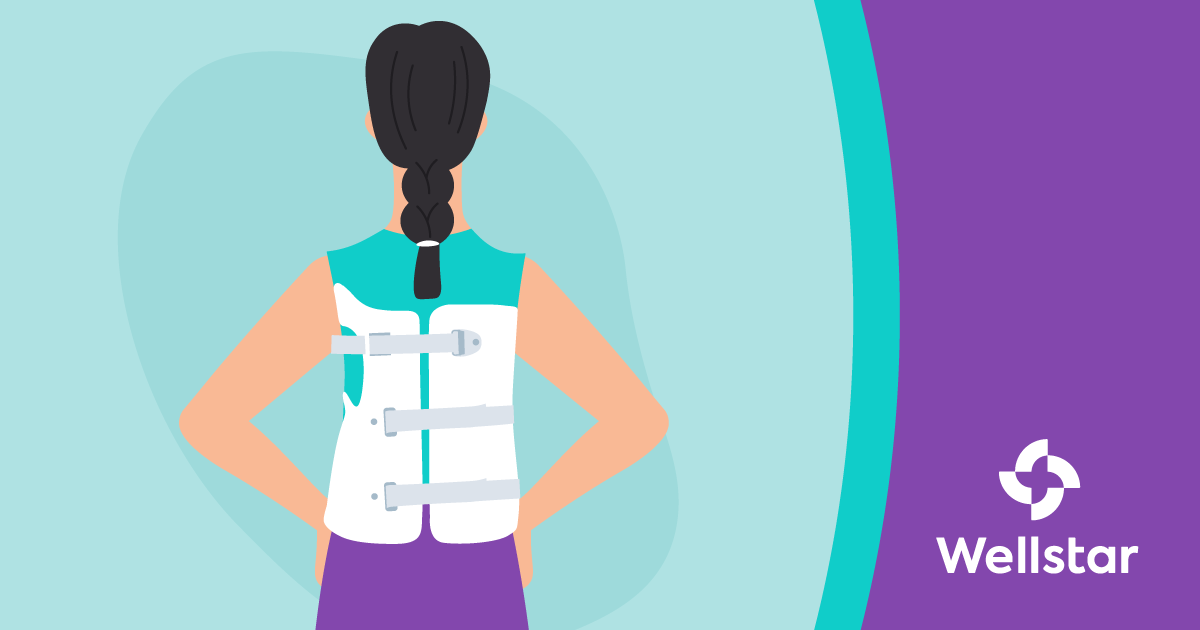 Comfortably Treating Scoliosis with 3DPrinted Braces