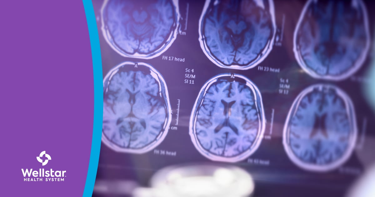 Image of a brain scan