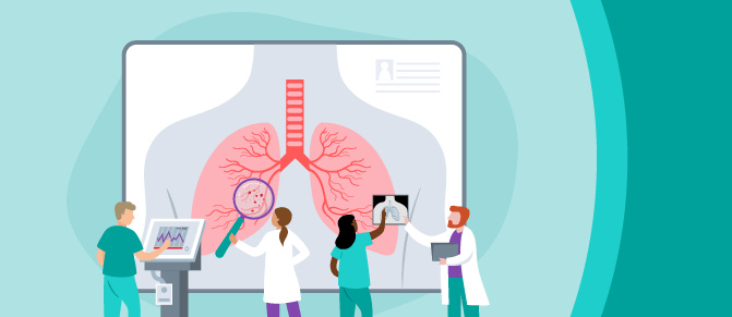 Illustration of physicians reviewing lung cancer image on a screen