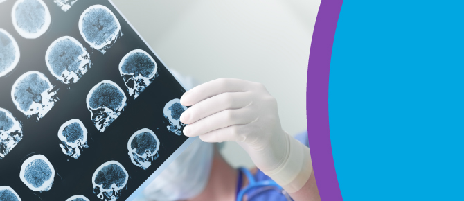 Doctor looking at head scans