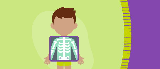 Illustration of child getting X-ray