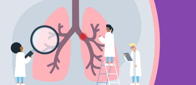 Doctors inspecting lungs