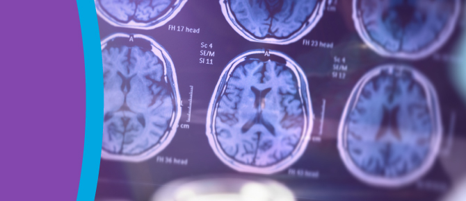 Brain scan