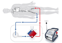 An ECMO-trained physician inserts tubes — or cannulas — into specific blood vessels. These tubes remove blood from the body to flow through the ECMO machine where an oxygenator — also known as an artificial lung — removes the carbon dioxide in the blood, and oxygen is replenished before it pumps back into the body.